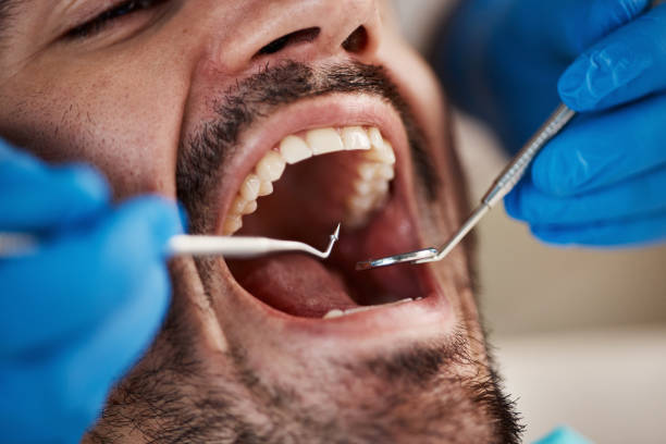 Best Broken or Cracked Tooth Emergency Dentist in Peosta, IA