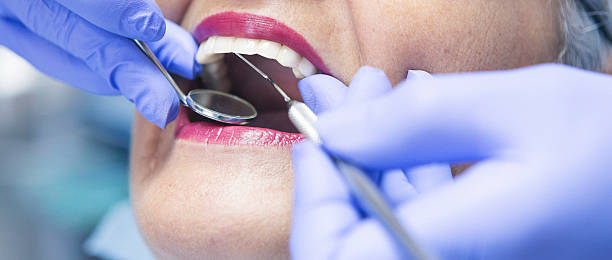 Best Emergency Dental Care for Abscessed Tooth in Peosta, IA